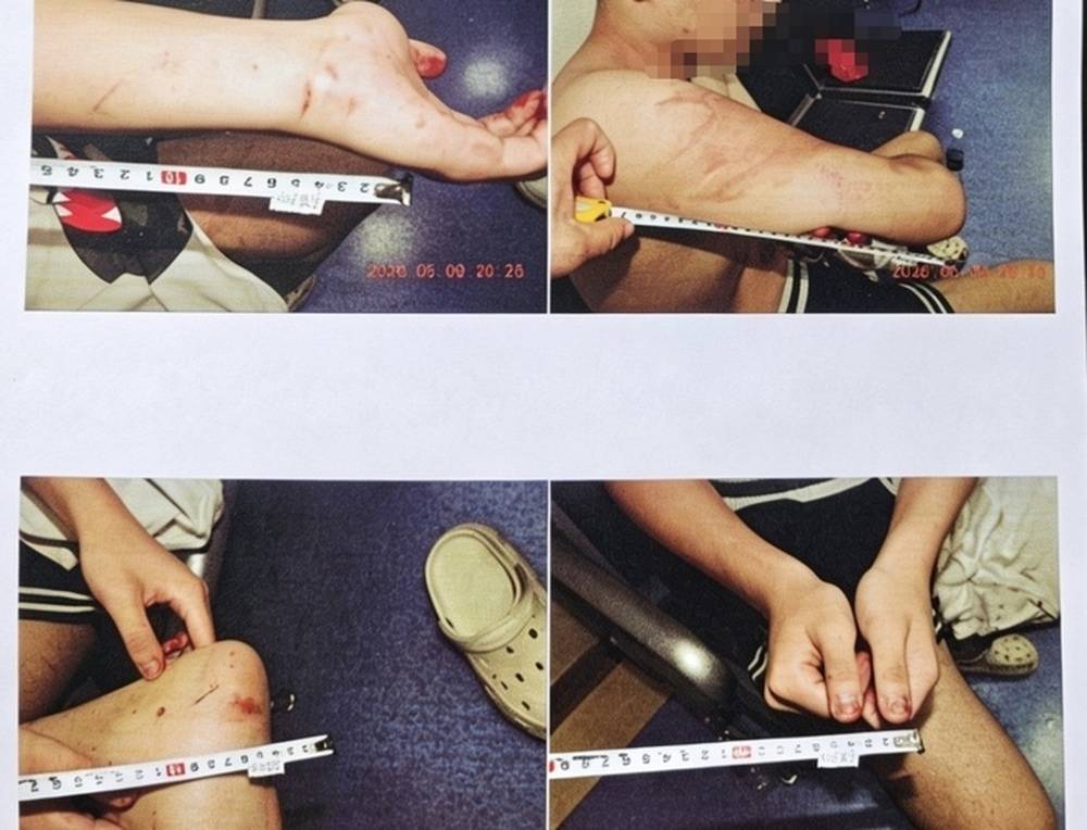 17岁男生家门口遭两次殴打案最新进展：伤情鉴定为轻伤二级，警方以涉嫌寻衅滋事罪进行侦办